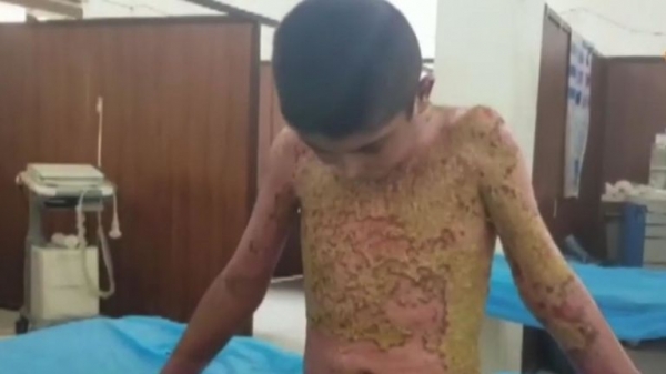 
Turkish President Erdogan vows to 'crush the heads' of Kurds in Syria
