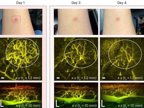 New miniature scanner could revolutionise diagnosis of diseases like cancer, diabetes and arthritis New miniature scanner could revolutionise diagnosis of diseases like cancer, diabetes and arthritis