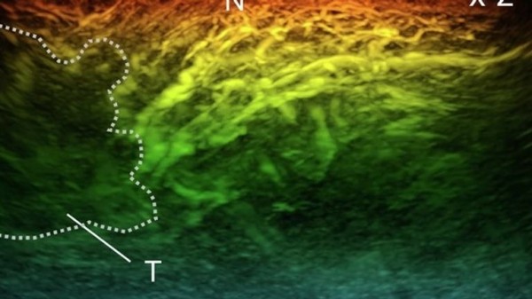 New miniature scanner could revolutionise diagnosis of diseases like cancer, diabetes and arthritis New miniature scanner could revolutionise diagnosis of diseases like cancer, diabetes and arthritis