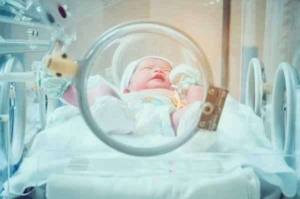 Preterm births rising in United States Preterm births rising in United States
