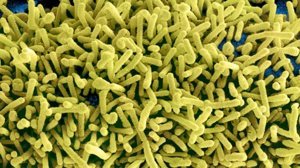 Deadly Marburg virus outbreak in Rwanda has health officials on high alert Deadly Marburg virus outbreak in Rwanda has health officials on high alert