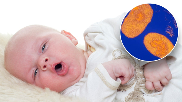 Whooping cough cases up more than 340% over this time last year Whooping cough cases up more than 340% over this time last year