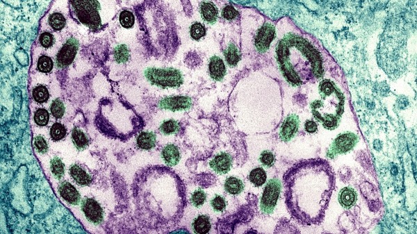 Deadly Marburg virus outbreak in Rwanda has health officials on high alert Deadly Marburg virus outbreak in Rwanda has health officials on high alert