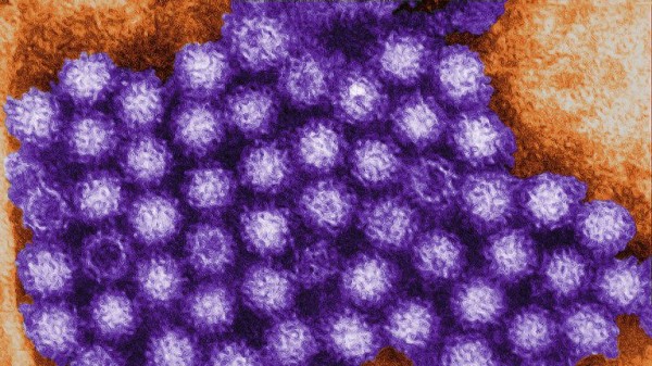 British volunteers sought for trial of vaccine to protect against norovirus British volunteers sought for trial of vaccine to protect against norovirus