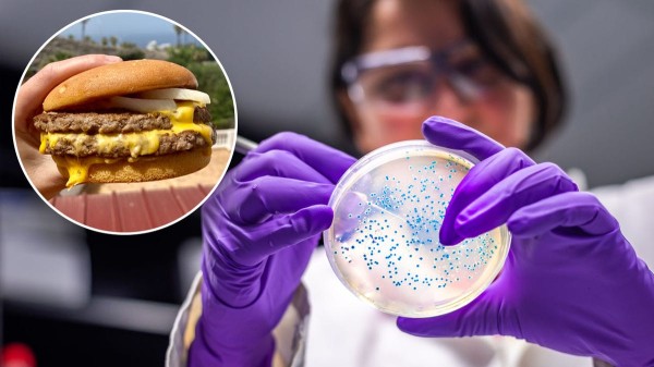 E. coli outbreak linked to McDonald’s burgers: How to spot the symptoms E. coli outbreak linked to McDonald’s burgers: How to spot the symptoms