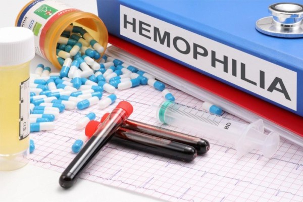 FDA approves first once-weekly drug treatment regimen for hemophilia FDA approves first once-weekly drug treatment regimen for hemophilia