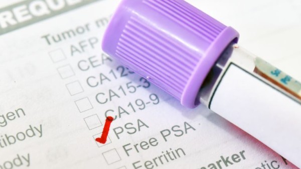 Prostate cancer test shown to 'reduce number of deaths' - as charity calls for change Prostate cancer test shown to 'reduce number of deaths' - as charity calls for change