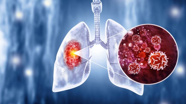 Legionnaires’ disease outbreak linked to cruise ship hot tubs, CDC says Legionnaires’ disease outbreak linked to cruise ship hot tubs, CDC says