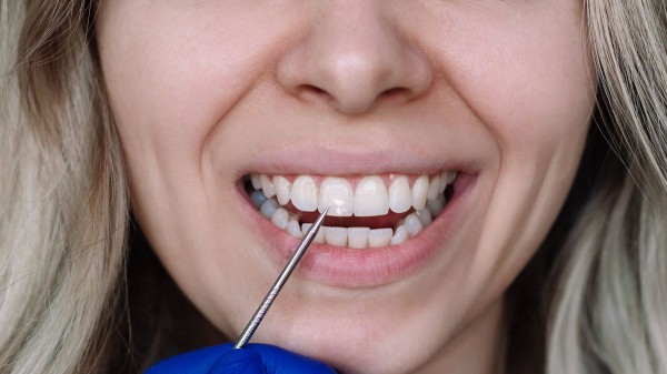 RFK Jr. calls for removal of fluoride from drinking water, sparking debate RFK Jr. calls for removal of fluoride from drinking water, sparking debate