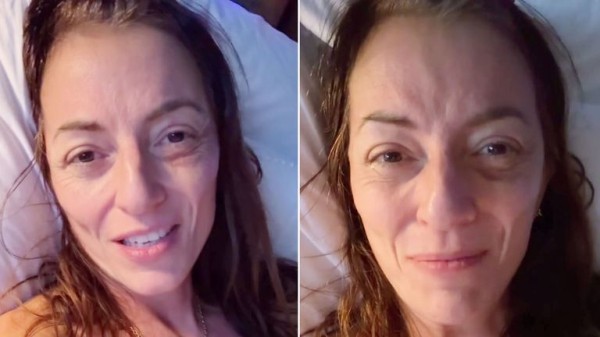 Davina McCall says she has short-term memory problems after brain tumour surgery Davina McCall says she has short-term memory problems after brain tumour surgery