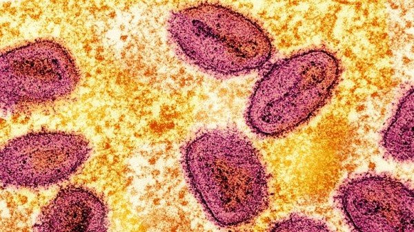 Mpox: More cases of new Clade 1b strain detected in UK Mpox: More cases of new Clade 1b strain detected in UK