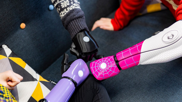 'Best Christmas gift' ever as kids with missing limbs receive bionic arms: 'Amazing' 'Best Christmas gift' ever as kids with missing limbs receive bionic arms: 'Amazing'