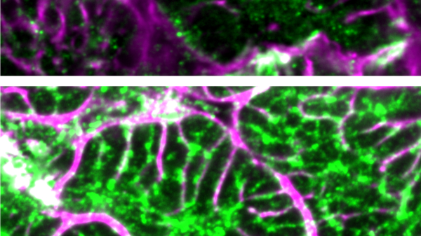 Heart failure is reversed with new gene therapy in animal study: ‘Unprecedented recovery’ Heart failure is reversed with new gene therapy in animal study: ‘Unprecedented recovery’