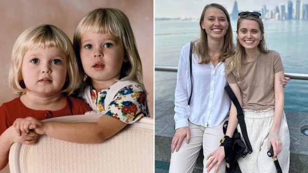 Rare disease diagnosis strengthens bond between twin sisters: ‘Doing our best’ Rare disease diagnosis strengthens bond between twin sisters: ‘Doing our best’