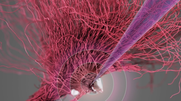 New brain therapy allows paralyzed patients to walk again: 'I feel my legs' New brain therapy allows paralyzed patients to walk again: 'I feel my legs'