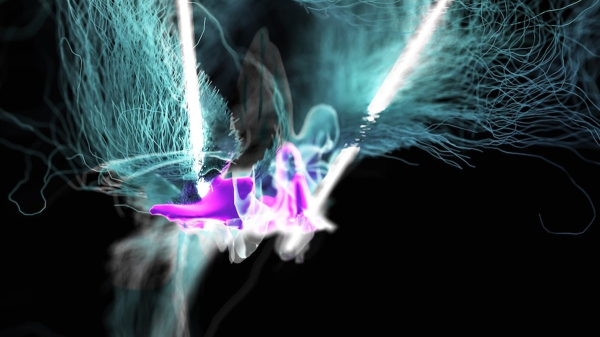 New brain therapy allows paralyzed patients to walk again: 'I feel my legs' New brain therapy allows paralyzed patients to walk again: 'I feel my legs'