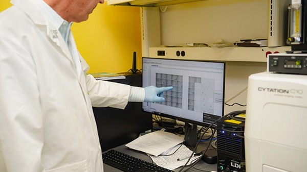 Cooking oil linked to colon cancer in early study, tied to inflammation