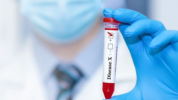 ‘Disease X’ has killed dozens in the Congo — here’s what to know about the mystery illness ‘Disease X’ has killed dozens in the Congo — here’s what to know about the mystery illness