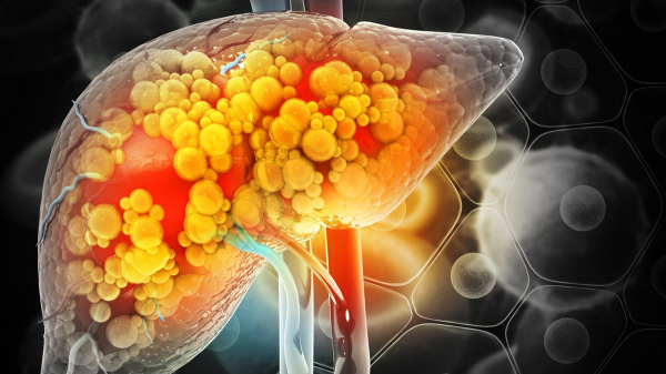 Alcohol deaths have more than doubled in recent years, especially among women