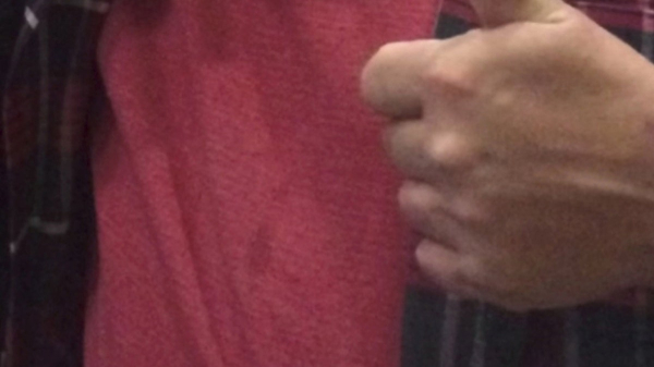 Liver cancer patient given 6 months to live loses 76 pounds eating specific foods Liver cancer patient given 6 months to live loses 76 pounds eating specific foods