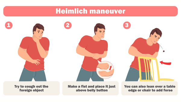 Choking emergency? How to do the Heimlich maneuver — and when to avoid it Choking emergency? How to do the Heimlich maneuver — and when to avoid it