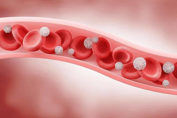 Study links long COVID severity with white blood cell count Study links long COVID severity with white blood cell count