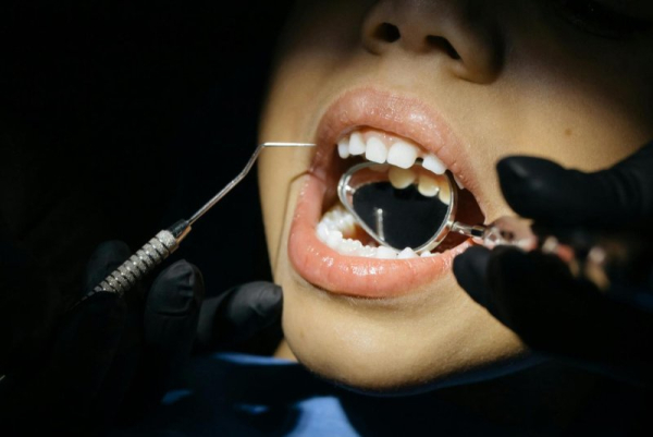 U.S. children's dental care falls short at home, national poll reports U.S. children's dental care falls short at home, national poll reports