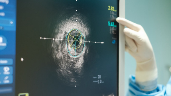 Heart disease could be prevented with this one simple test