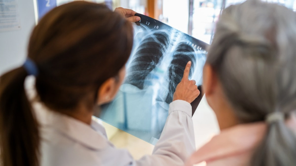 Lingering lung disorders 5 years post-COVID: Here's what to know