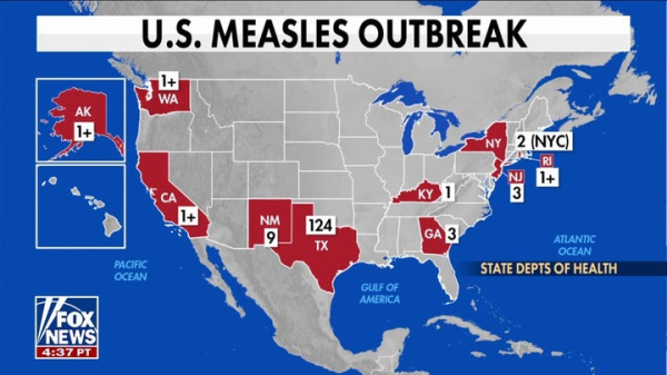 Measles more likely to be severe among malnourished, RFK says Measles more likely to be severe among malnourished, RFK says