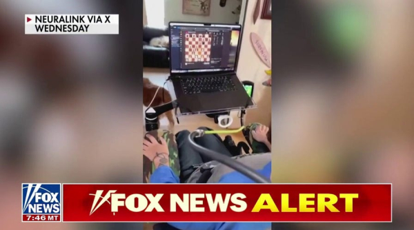 Paralyzed man with ALS is third to receive NeuraLink implant, can type with brain