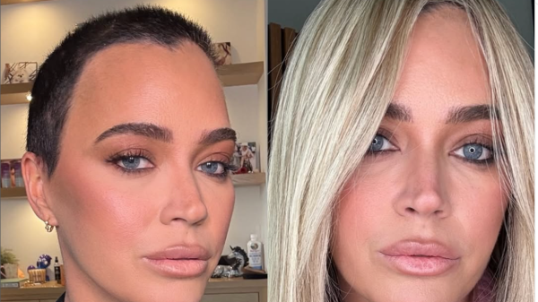 Reality star shares deadly melanoma update as doctors discuss prognosis Reality star shares deadly melanoma update as doctors discuss prognosis