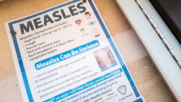 Measles outbreaks now declared in 8 states, including Michigan's first in 5 years Measles outbreaks now declared in 8 states, including Michigan's first in 5 years