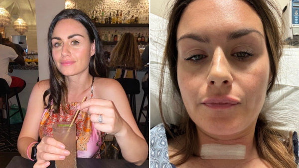 Woman says ChatGPT saved her life by helping detect cancer, which doctors missed