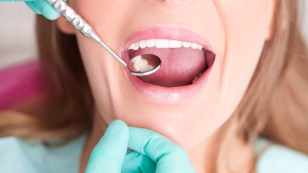 Most common causes of cavities in the teeth — and how to prevent them Most common causes of cavities in the teeth — and how to prevent them