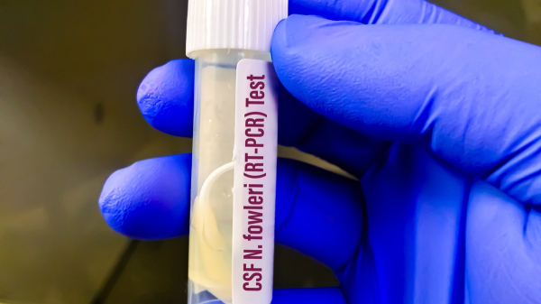 Woman dies of brain-eating amoeba after using tap water in nasal rinse device