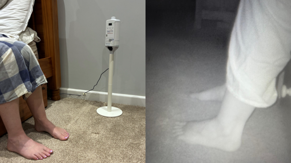 AI foot scanner recognises warning signs of heart failure to keep people out of hospital, researchers say AI foot scanner recognises warning signs of heart failure to keep people out of hospital, researchers say