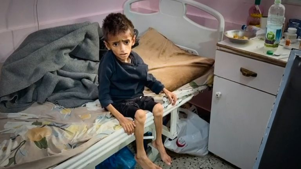 Amputations, badly burned bomb victims and lack of medicine: British surgeons on life in Gaza