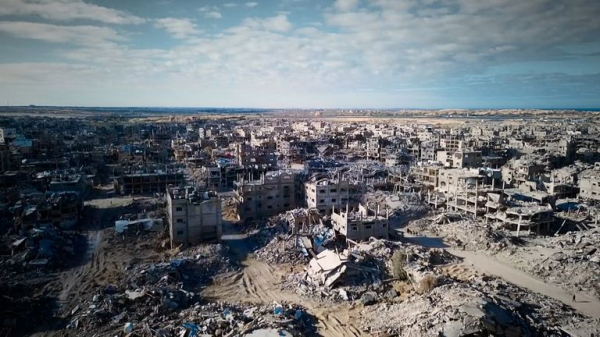 Amputations, badly burned bomb victims and lack of medicine: British surgeons on life in Gaza