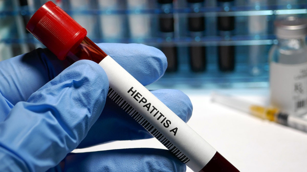 Hepatitis A outbreak infects thousands of travelers at popular destinations Hepatitis A outbreak infects thousands of travelers at popular destinations