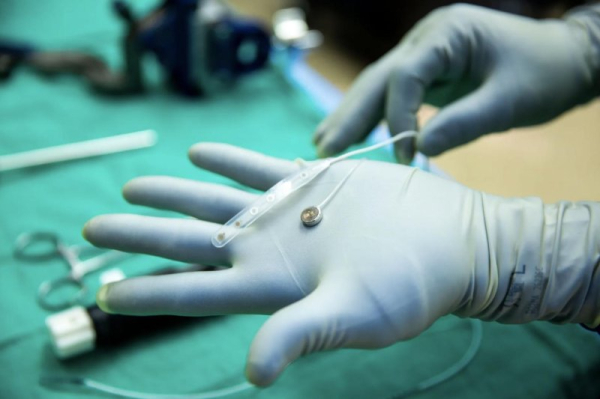 Paradromics implants brain-computer interface into first human patient