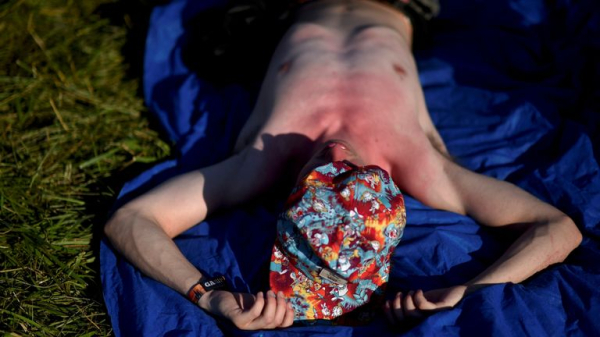 Sunburn isn't just red skin - here's what's happening underneath the burn Sunburn isn't just red skin - here's what's happening underneath the burn