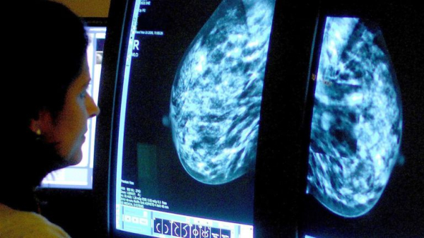 'Transformational' new drug could stop breast cancer tumours before they grow, trial finds 'Transformational' new drug could stop breast cancer tumours before they grow, trial finds