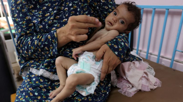25% of young children and pregnant women malnourished in Gaza, charity says, as PM vows to fly critical medical cases to UK  25% of young children and pregnant women malnourished in Gaza, charity says, as PM vows to fly critical medical cases to UK