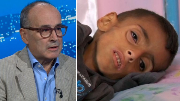 25% of young children and pregnant women malnourished in Gaza, charity says, as PM vows to fly critical medical cases to UK  25% of young children and pregnant women malnourished in Gaza, charity says, as PM vows to fly critical medical cases to UK