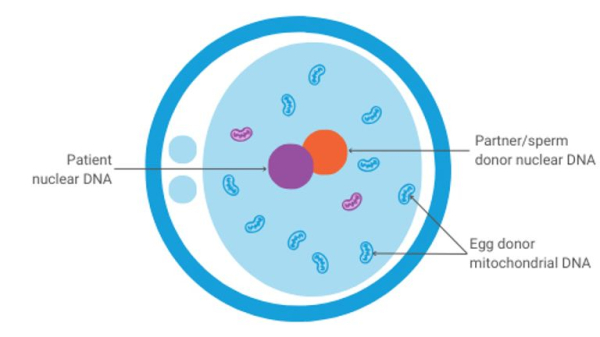 Babies born with DNA from three people in the UK - to prevent 'devastating' illness with no cure Babies born with DNA from three people in the UK - to prevent 'devastating' illness with no cure