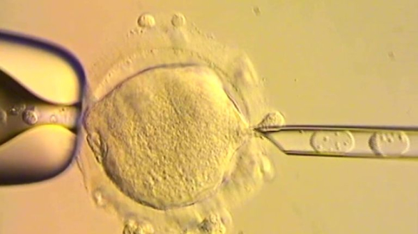 Babies born with DNA from three people in the UK - to prevent 'devastating' illness with no cure Babies born with DNA from three people in the UK - to prevent 'devastating' illness with no cure