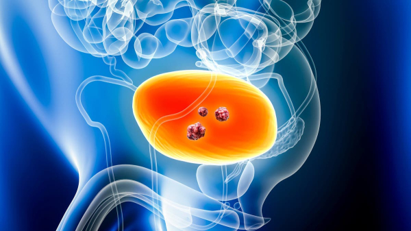 Doctors share bladder cancer warning signs after Deion Sanders reveals diagnosis and recovery Doctors share bladder cancer warning signs after Deion Sanders reveals diagnosis and recovery