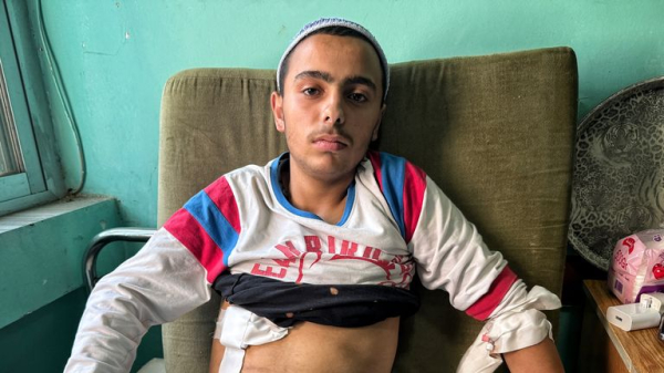 Rows of decomposing bodies that haven't been buried because of fierce fighting in Syrian city