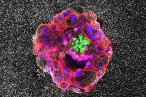 'Astonishing' video shows human embryo implanting in real time 'Astonishing' video shows human embryo implanting in real time